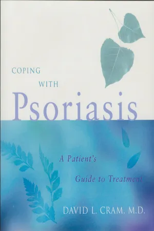 Coping with Psoriasis