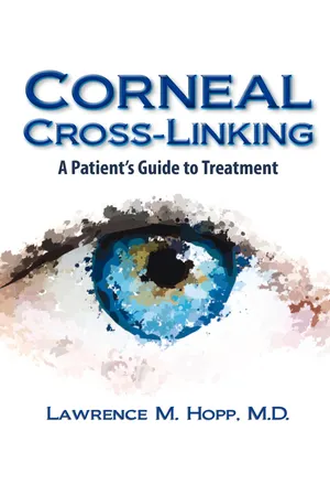 Corneal Cross-Linking