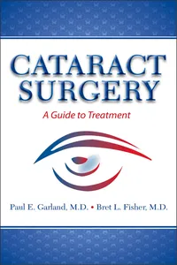 Cataract Surgery_cover