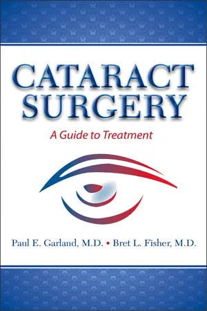 Cataract Surgery