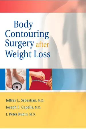 Body Contouring Surgery After Weight Loss