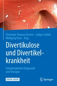 Divertikulose und Divertikelkrankheit_cover