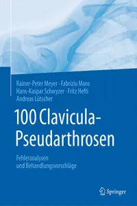100 Clavicula-Pseudarthrosen_cover