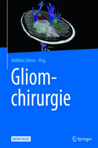 Gliomchirurgie_cover
