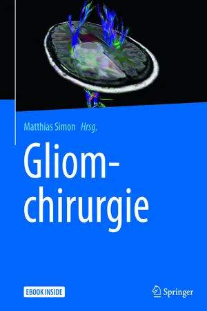Gliomchirurgie