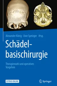 Schädelbasischirurgie_cover