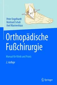 Orthopädische Fußchirurgie_cover