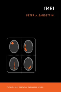 fMRI_cover
