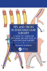Tips and Tricks in Endovascular Surgery_cover