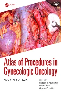 Atlas of Procedures in Gynecologic Oncology