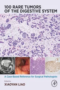 100 Rare Tumors of the Digestive System_cover