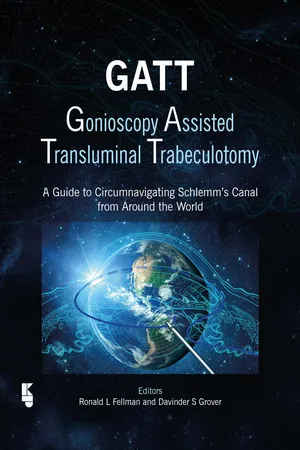 GATT: Gonioscopy Assisted Transluminal Trabeculotomy