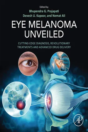 Eye Melanoma Unveiled