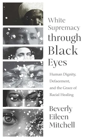 White Supremacy through Black Eyes