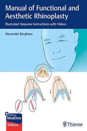 Manual of Functional and Aesthetic Rhinoplasty