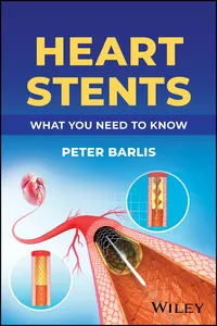 Heart Stents