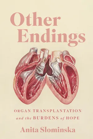 Other Endings