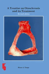 A Treatise on Otosclerosis and its Treatment_cover