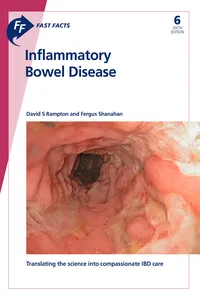 Fast Facts: Inflammatory Bowel Disease_cover
