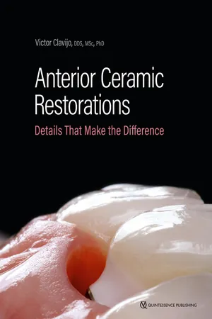 Anterior Ceramic Restorations