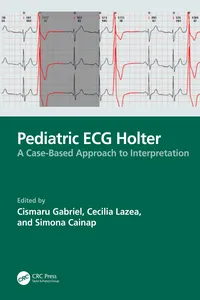 Pediatric ECG Holter