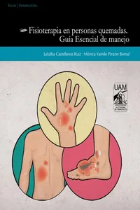 Fisioterapia en personas quemadas_cover