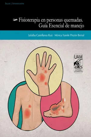 Fisioterapia en personas quemadas