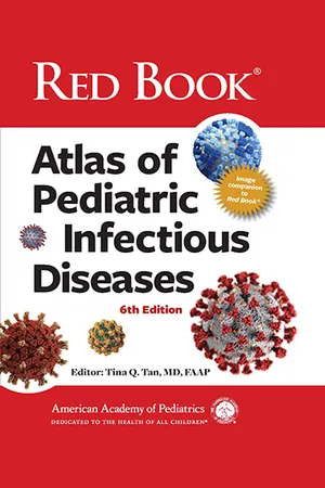 Red Book Atlas of Pediatric Infectious Diseases