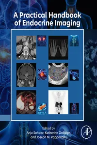 A Practical Handbook of Endocrine Imaging_cover