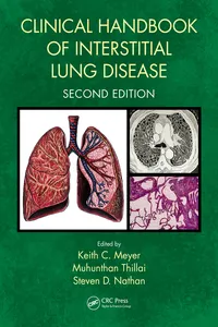 Clinical Handbook of Interstitial Lung Disease_cover