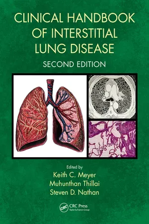 Clinical Handbook of Interstitial Lung Disease