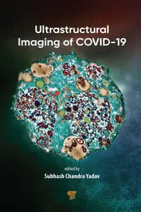 Ultrastructural Imaging of COVID-19_cover