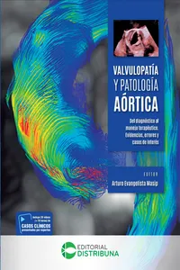 Valvulopatía y patología aórtica_cover