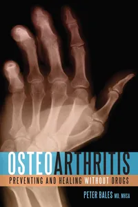 Osteoarthritis_cover