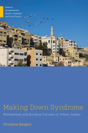 Making Down Syndrome
