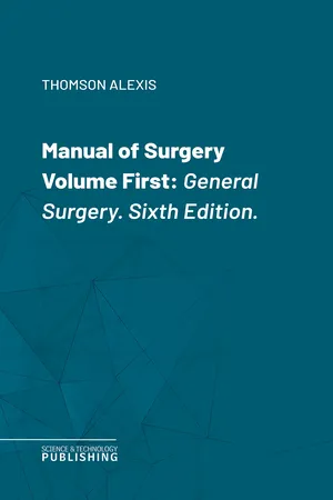 Manual of Surgery Volume First