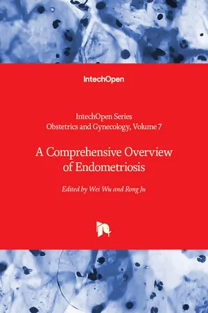 A Comprehensive Overview of Endometriosis