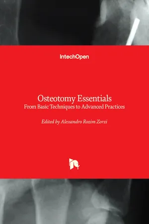 Osteotomy Essentials