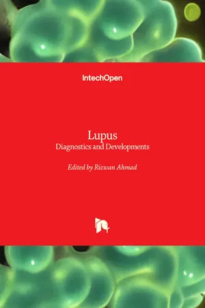 Lupus