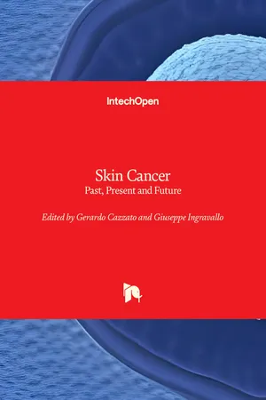 Skin Cancer