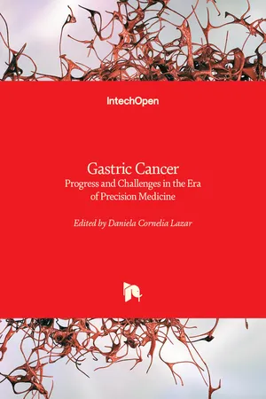 Gastric Cancer