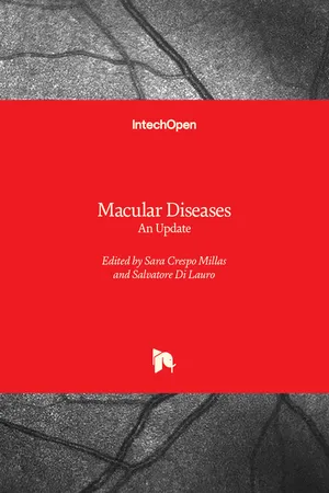 Macular Diseases
