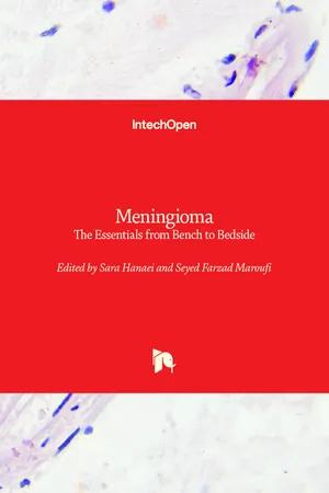 Meningioma