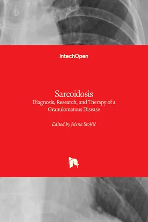 Sarcoidosis