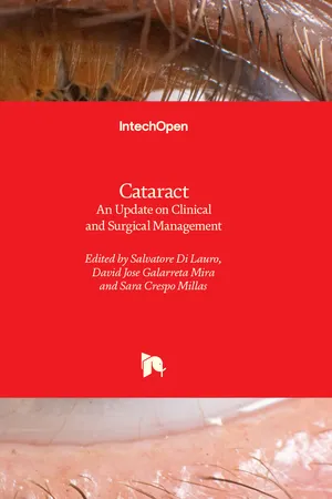 Cataract
