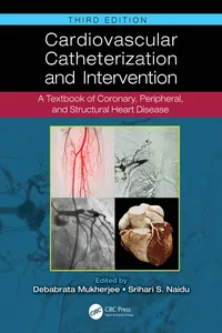 Cardiovascular Catheterization and Intervention