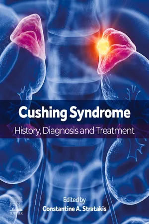 Cushing Syndrome