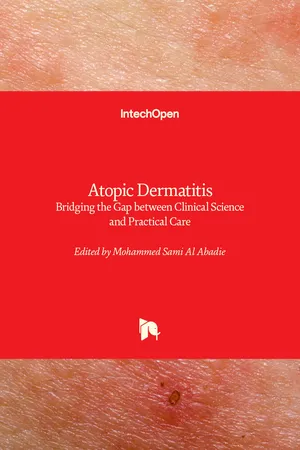 Atopic Dermatitis