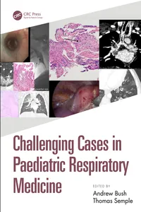 Challenging Cases in Paediatric Respiratory Medicine
