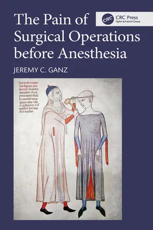 The Pain of Surgical Operations before Anesthesia